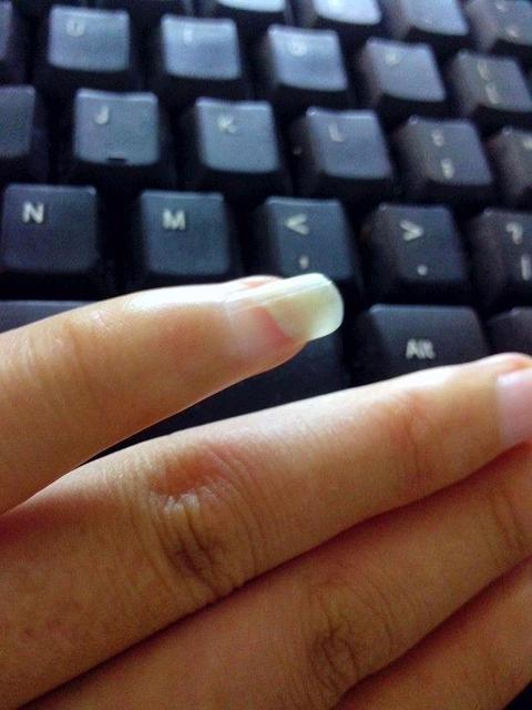 指甲竖纹白点月牙少