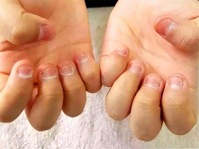 孩子爱咬指甲是怎么回事