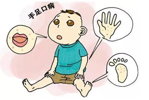 春天是手足口病的高发期吗