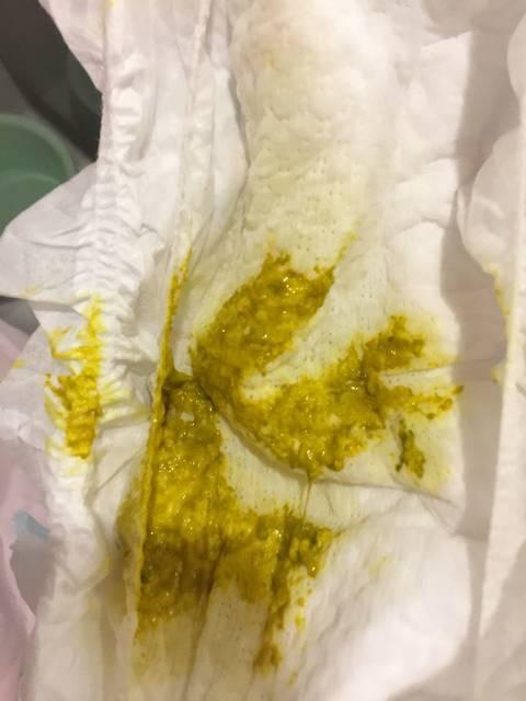 四岁宝宝吃益生菌好不好