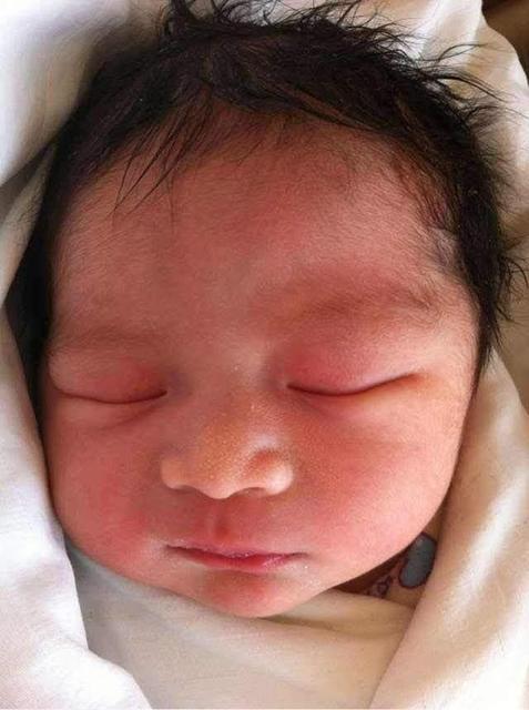 小宝宝头发长得慢怎么办