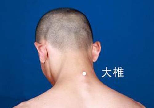 孩子生气会导致发烧吗