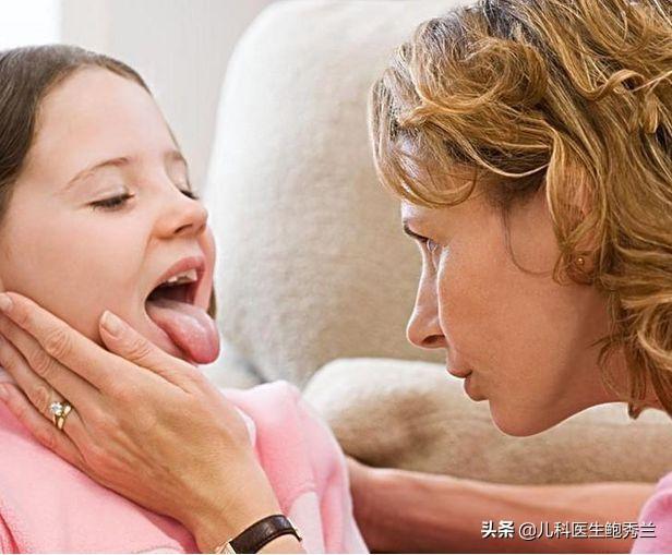 疱疹性咽峡炎一般几岁孩子得