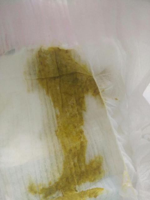7个月宝宝吃母乳拉肚子怎么办