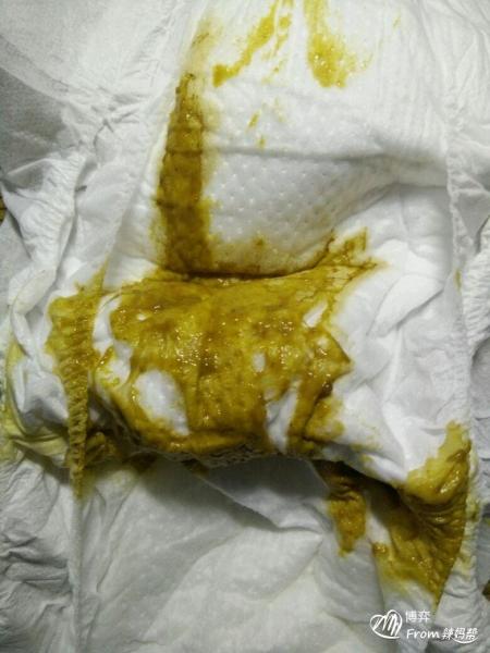 治疗宝宝秋季腹泻的13款食谱
