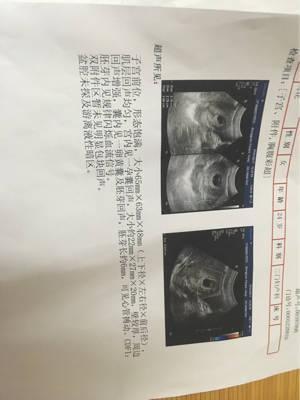 7周未见胎心胎芽正常吗