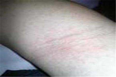 导致宝宝过敏的原因