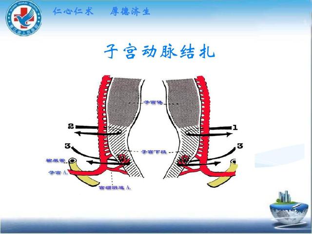 孕期出血的原因及解决办法