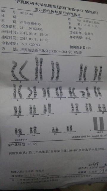 为什么羊水检查那么重要