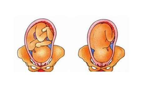 怀孕30周胎位图图片
