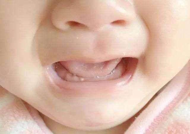 新生儿泪囊炎怎么回事