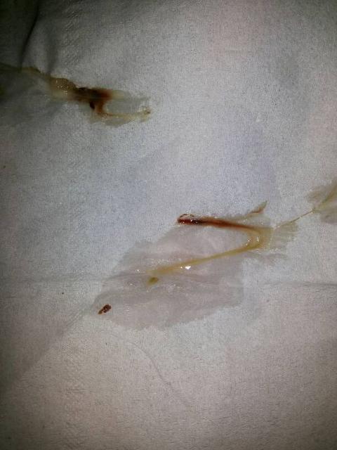孩子总是流鼻涕不好怎么办