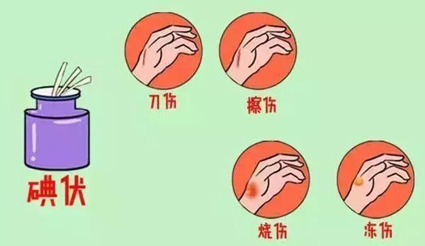 有伤口可以涂紫药水吗
