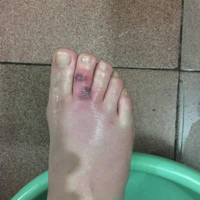 怎么办？怀孕后各种痒痒痒