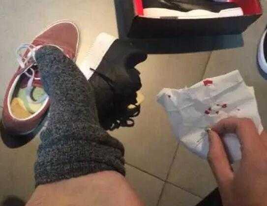 受伤了一定要打破伤风针吗