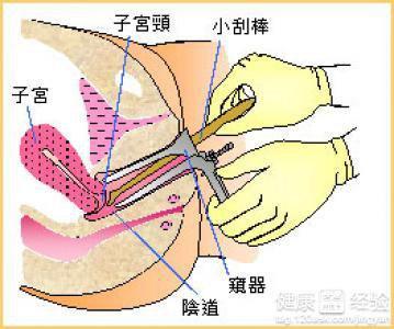 子宫内膜薄吃什么好