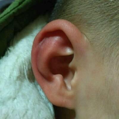 小孩子经常发热怎么回事