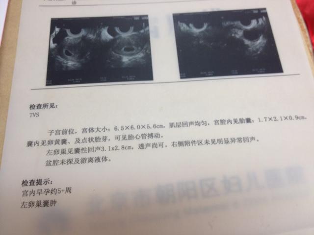 通过早期孕囊形状看性别准吗