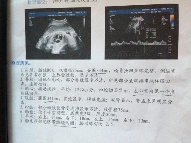 胎儿偏小一周是女孩吗