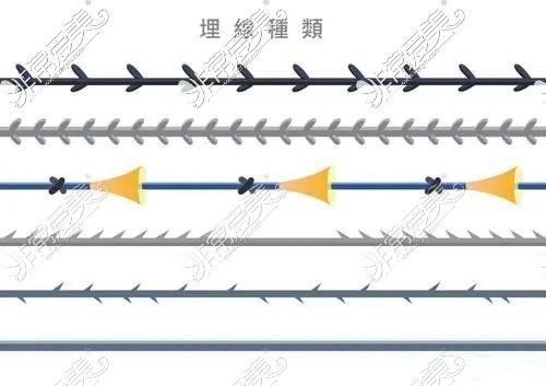 热玛吉做一次可以保持多久姐妹们
