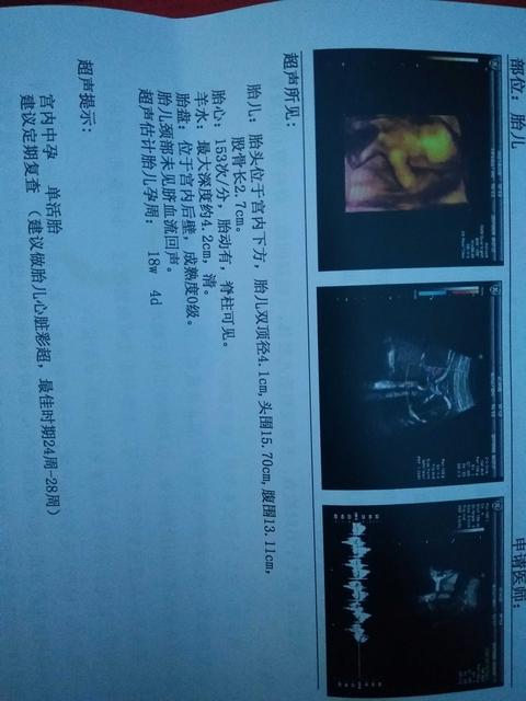 怀孕第几周最容易引起胎儿畸形