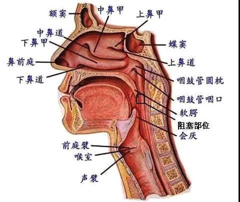 孩子扁桃体肥大需要手术吗