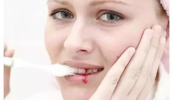 儿童使用过量牙膏或导致牙齿生斑