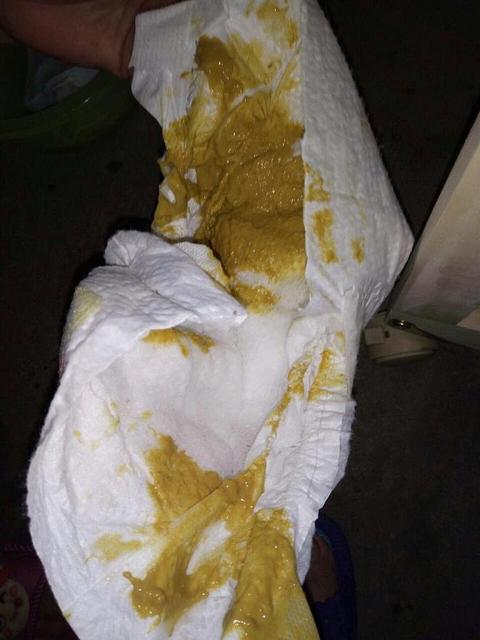 新生儿鼻子上的白点是什么东西
