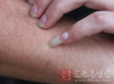 糖尿病的早期症状有哪些反应