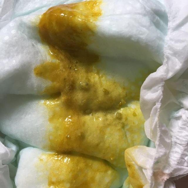 4个月宝宝腹泻怎么办才好
