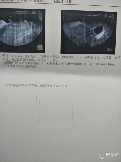 有卵泡不排卵好治吗
