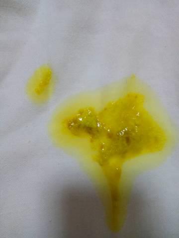 宝宝几天不拉大便是便秘