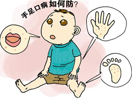 怎么预防手足口病的发生