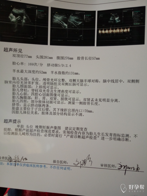 女人得了性疾病能怀孕吗