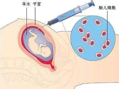 做了一件事特别后悔怎么办