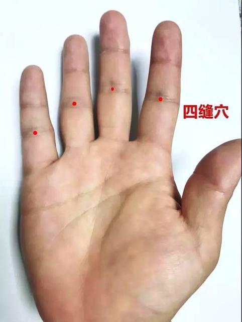小儿疳积怎么办?