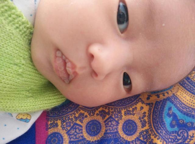 三个月的宝宝嘴唇发白是怎么回事