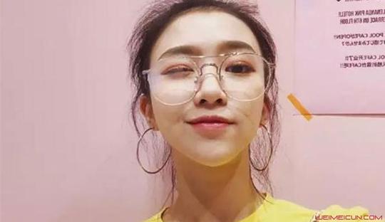 创造101林君怡为什么被淘汰中韩混血有实力淘汰有黑幕吗?