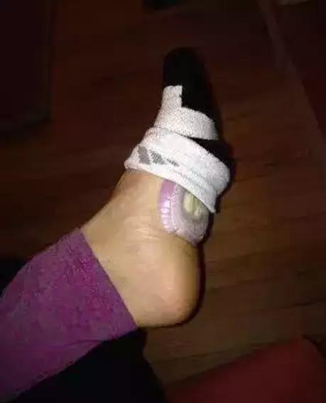 孩子鼻子不通气怎么办好点