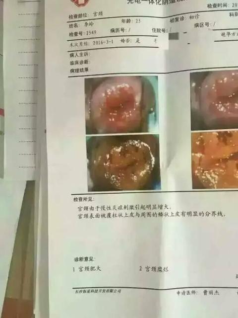 诊断性刮宫后多久来月经是正常的