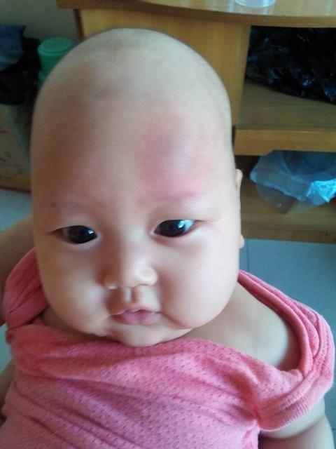 孩子从床上摔下去应该怎么办好