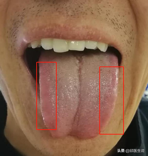 宝宝上火这6个部位有暗示哦