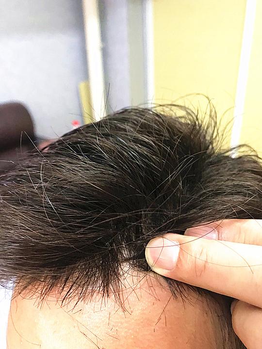 高档抖音同款补发隐形无痕补发生物头皮补发假发男补发片织发补