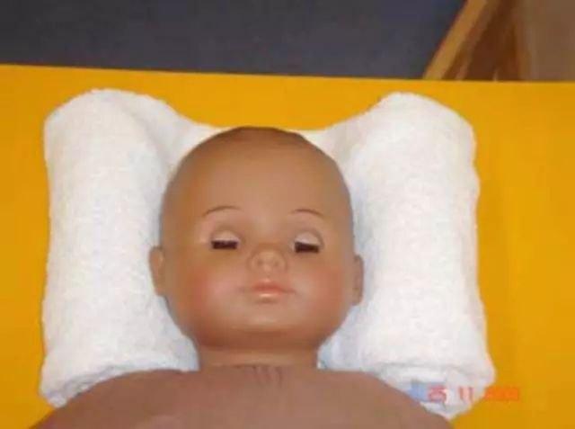 宝宝头总是歪向一边是斜颈吗