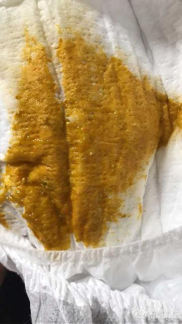 宝宝拉肚子有血丝怎么办?