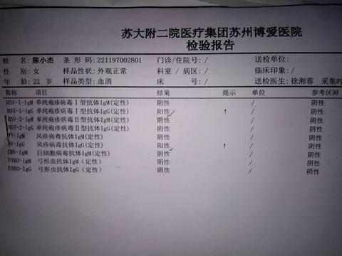 优生四项需要检查吗