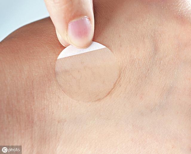 妈妈没有妊娠纹会遗传吗