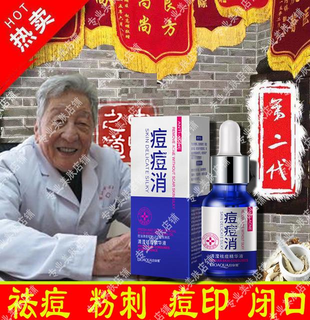 治疗痘痘的外用药有哪些
