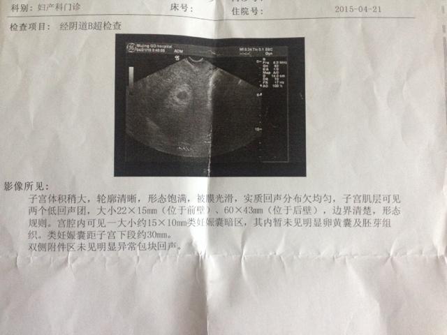 出现胎停有什么症状或征兆吗
