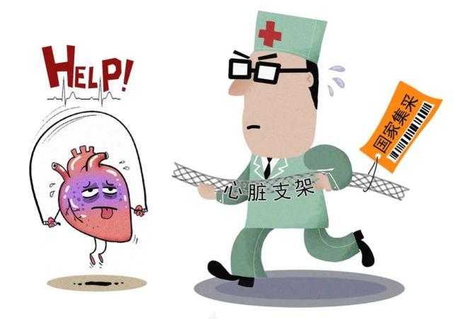 心脏支架大幅降价是什么原因